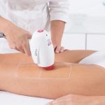 legs-laser-hair-removal