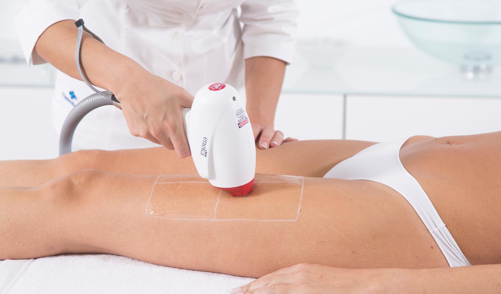 legs-laser-hair-removal