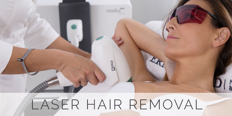 Laser Hair Removal